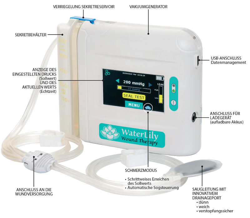 Waterlily TS Wundversorgung — Anwendung